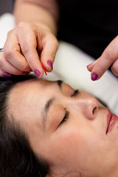 Close Up of Acupuncturist Inserting Needle in San Diego