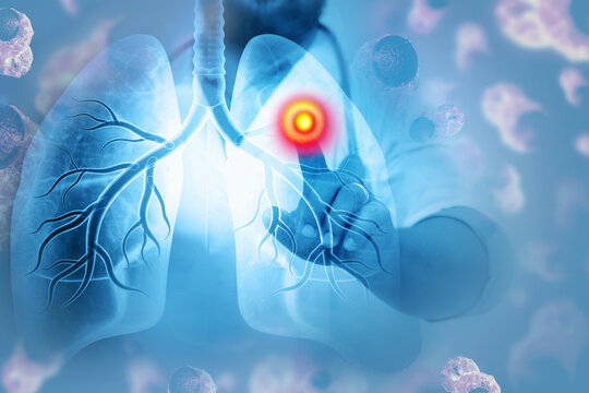 Doctor check and diagnose the human lungs. chronic obstructive pulmonary disease,respiratory diseases, 3d illustration
