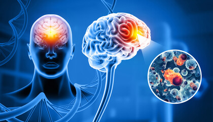 Cancer cells attacking a human brain. 3d illustration