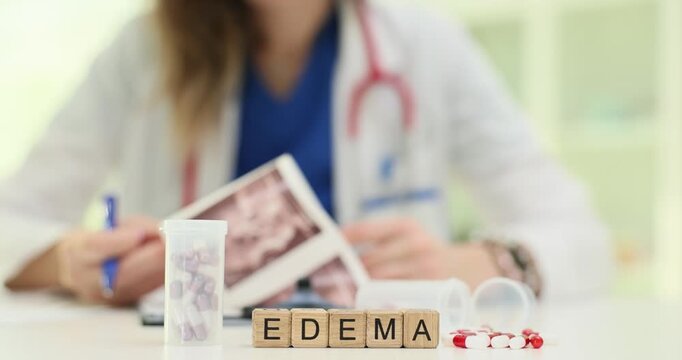 Wooden blocks spell word Edema near dental model and pills on table. Woman doctor compares gum swelling scan photos planning treatment carefully