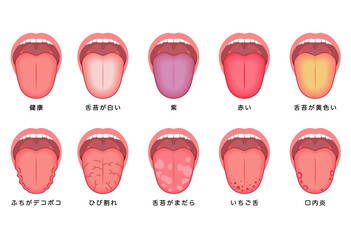 舌でわかる健康状態　舌診　舌の健康