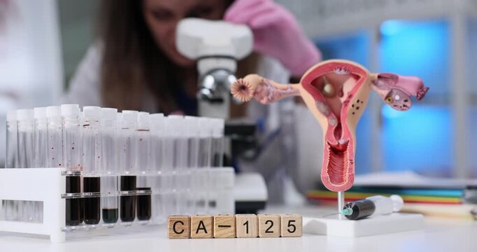 Wooden blocks spell marker CA 125 near uterus model on table. Woman gynecologist studies lab results recording ovarian cancer screening data