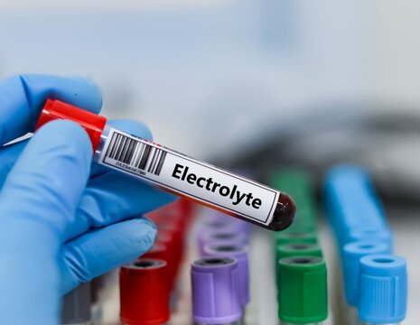 Blood sample tube for electrolyte test analysis.