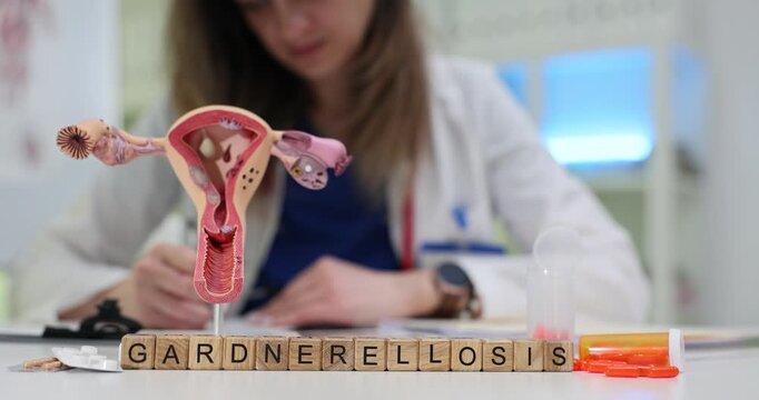 Word Gardnerellosis of wooden blocks and uterus anatomical model on table in hospital. Woman gynecologist analyses patient for bacterial vaginosis