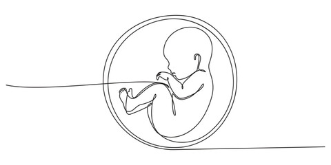 Baby embryo in womb, fetus one art line continuous drawing, Continuous line of fetus in womb.one line drawing of baby fetus in mother's stomach in gestational age.