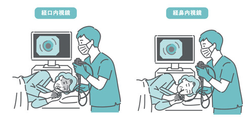 高齢女性の経口内視鏡と経鼻内視鏡の比較イラスト（苦痛と安楽の違い） © トワトワ