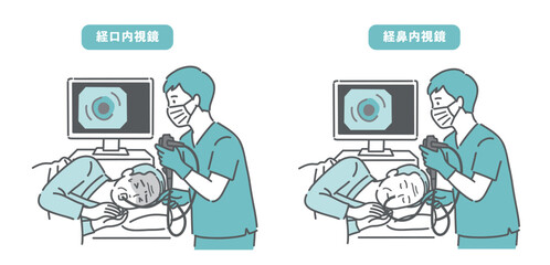 高齢男性の経口内視鏡と経鼻内視鏡の比較イラスト（苦痛と安楽の違い）