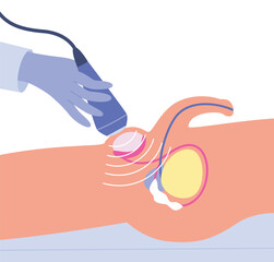 Testicular ultrasound. Male reproductive system diagnostic. Flat vector illustration of medical diagnostic procedure