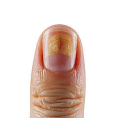 Human thumb finger nail with Transparent Background