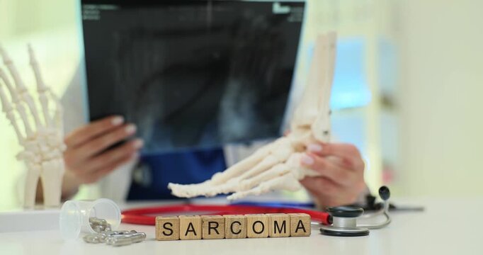 Wooden blocks spell word Sarcoma near foot skeleton model. Woman doctor studies X-ray image while assessing bone tumor treatment need at appointment