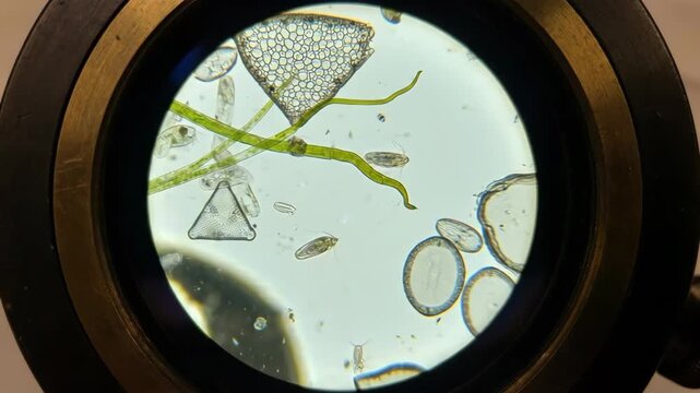 Various microorganisms, including diatoms, filamentous algae, and protozoa, thriving in a drop of water, displaying the complexity of aquatic ecosystems at a magnified scale