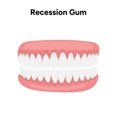 Obraz premium Hand-drawn dental illustration showing gum recession. Educational visual explaining receding gums and oral health problems