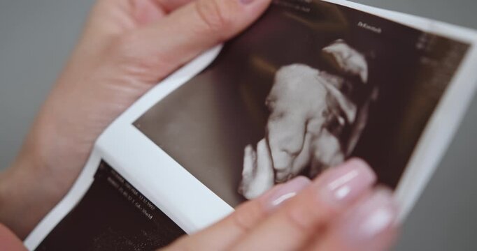 Close-up of woman's hands holding and pointing at 3D ultrasound image of baby's face, showing anticipation and joy. Woman Holding Ultrasound Photo