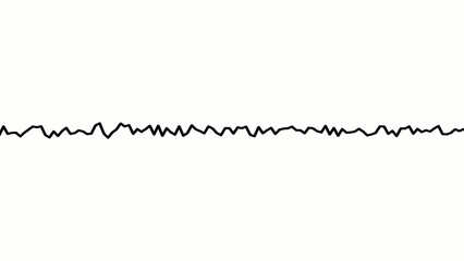 Generate title without using the word "Title:" before it. Black jagged heartbeat line graph with irregular rhythm on white background stock 1765535399915
