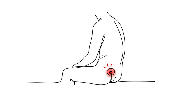 Minimalist Line Art of Hemorrhoids or Anal Discomfort and Rectal Swelling, Proctology Illustration for Gastrointestinal Pain, Perianal Pain, and Colon Health Concept Awareness