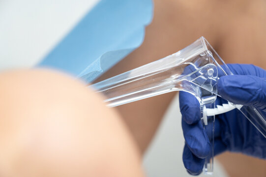 Doctor examining patient using vaginal speculum for gynecology visit
