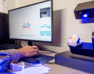 3D scanning of dental gypsum model using CAD CAM scanner in lab, part of digital dentistry workflow...