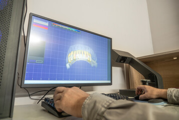Fototapeta premium Digital dental design 3D modeling of teeth using CAD CAM software for creating metal-ceramic dental crowns, prosthodontics, computer-aided design.