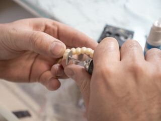 Dental technician polishing ceramic dental bridge using rotary tool in lab, creating metal-ceramic crowns, prosthodontics, cosmetic dentistry, precision work.