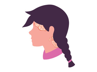 Psoriasis on the Scalp Illustration
