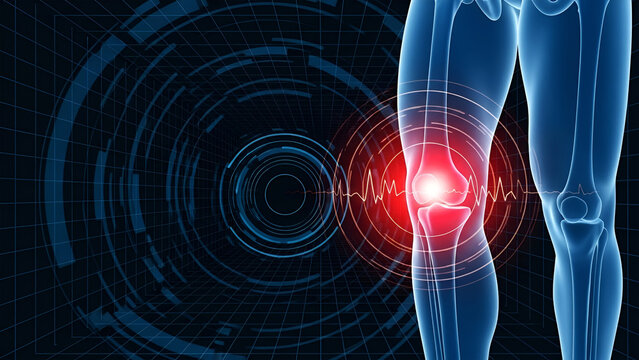 Advanced medical imaging of a kneecap
