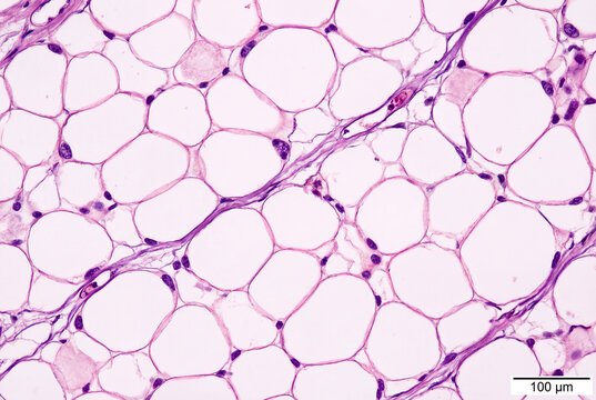 Microscopic view of human fat tissue with large, white adipocytes and stained connective tissue fibers visible under the microscope.