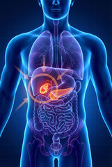 Digital illustration highlighting gallbladder cancer within the human anatomy, featuring arrows pointing to the affected area in the digestive system.