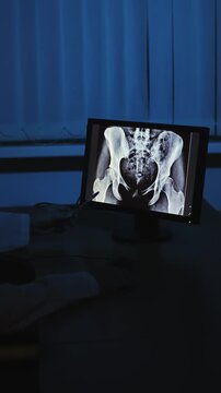 X-ray. Hip joint. Vertical video. Slow motion. High quality 4k footage