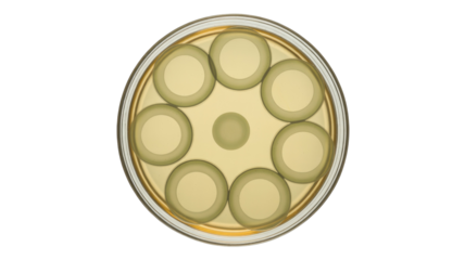 Petri dish with bacterial colonies. Isolated