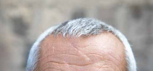  Caucasian man with white hair.