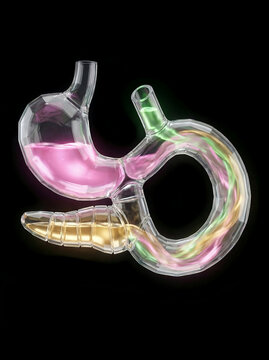 Abstract Glass Anatomy: Post-Whipple Digestive Flow of Bile, Enzymes, and Stomach Acid
