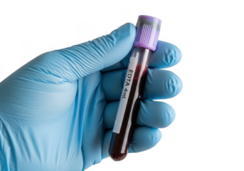 Hand holding blood test tube in medical glove isolated on transparent background for healthcare and science design