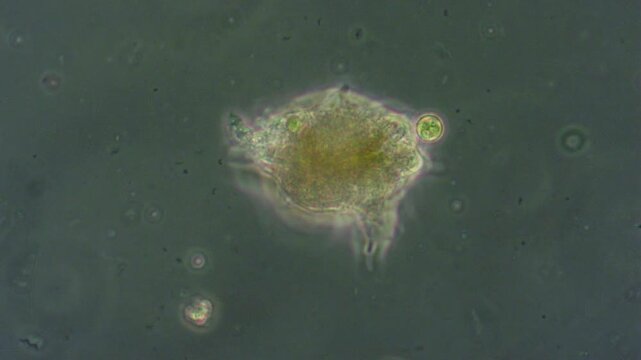 An amoeba slowly captures a single-celled green alga and consumes it, slowly moving through the water under a microscope.