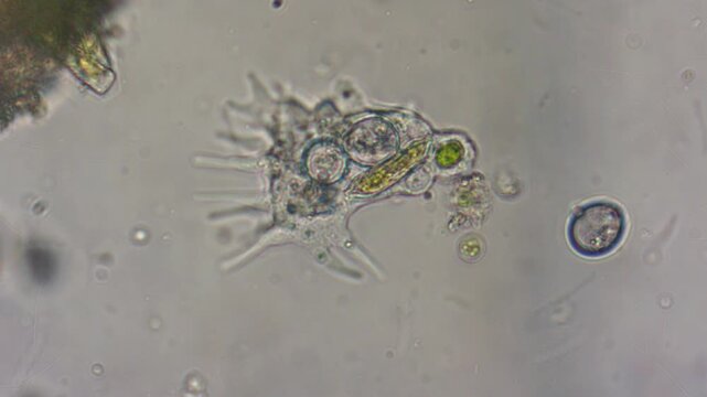 A transparent amoeba cell with organelles extends its pseudopodia for movement.