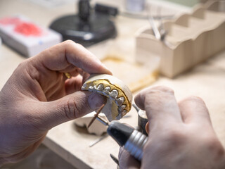 Dental technician polishing metal dental crown on plaster model using rotary tool in modern dental laboratory.