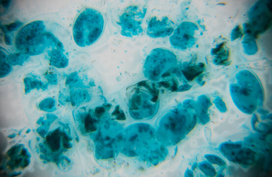 Microscopic view of blue and green cells with varying shapes and sizes on a light background, displaying cellular structures and textures in a laboratory setting - Powered by Adobe