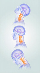 Three head positions, extension neutral and flexion, highlighting cervical spine in orange. Medical illustration for anatomy, posture education, physiotherapy, and spinal biomechanics content.