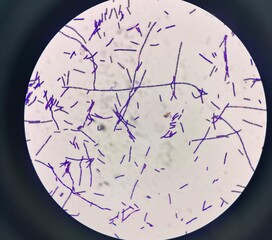 Bacteria Under Microscope Showing Rod Shaped Bacterial Cells