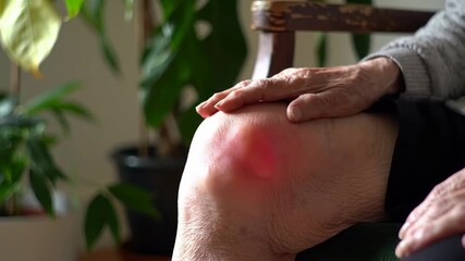 Close up of a senior's knee showing painful redness, seated indoors near plants. Captures joint inflammation, discomfort and aging related health issues.