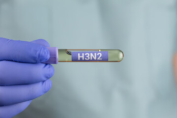 Obraz premium A doctor's hand holding a test tube labeled H3N2. Concept of influenza virus detection, laboratory diagnosis, infectious disease testing, and public health awareness.