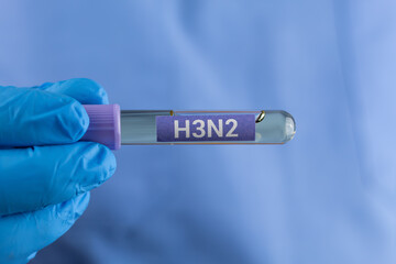 Obraz premium A doctor's hand in a blue glove holding a test tube labeled H3N2. Influenza virus detection, laboratory diagnosis, infectious disease testing, and public health concept.