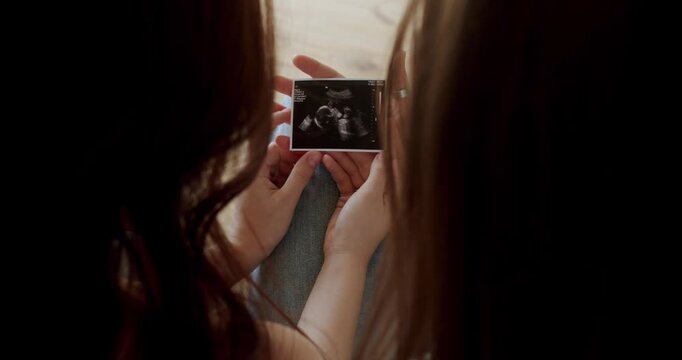 Happiness of motherhood, Lesbians waiting for baby Embracing and looking at ultrasound picture. Lesbian family. Women Lgbt Couple rest at home. Two women sharing love and support holding hands.