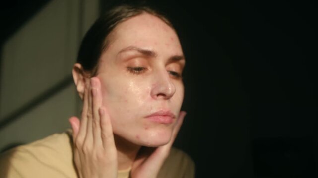 Young woman with problematic skin applying moisturizing cream to her face during her morning skincare routine, massaging the product with her fingers in the sunlight for a healthy glow