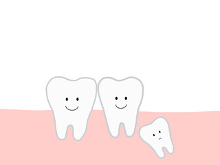 歯の成長・生え変わり：埋没歯・埋伏歯のあるイラスト・主線あり