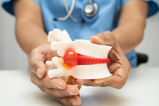 Asian doctor holding spinal nerve and bone model.