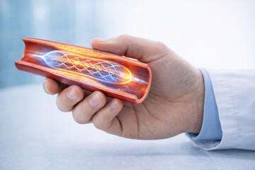 Medical professional holds vascular stent model inside artery showing x ray style hologram effect and advanced medical technology visualization with glowing flow and diagnostic detail