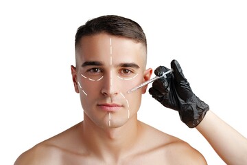 Man receiving cosmetic treatment in a clinical setting with facial markings