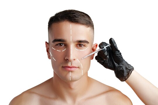 Man receiving cosmetic treatment in a clinical setting with facial markings