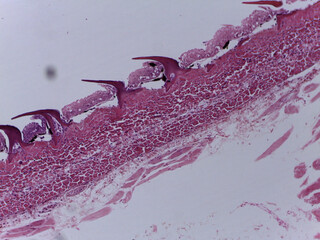 Microscopic Texture of Dogfish Shark Skin and Placoid Scale Morphol © Mohammed