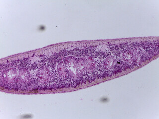 Microscopic Anatomy of Planaria Flatworm and Comparative Biological Specimen Slide Collec © Mohammed
